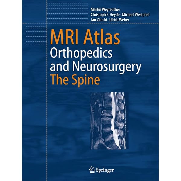 MRI Atlas: Orthopedics and Neurosurgery, The Spine: 9783540335337
